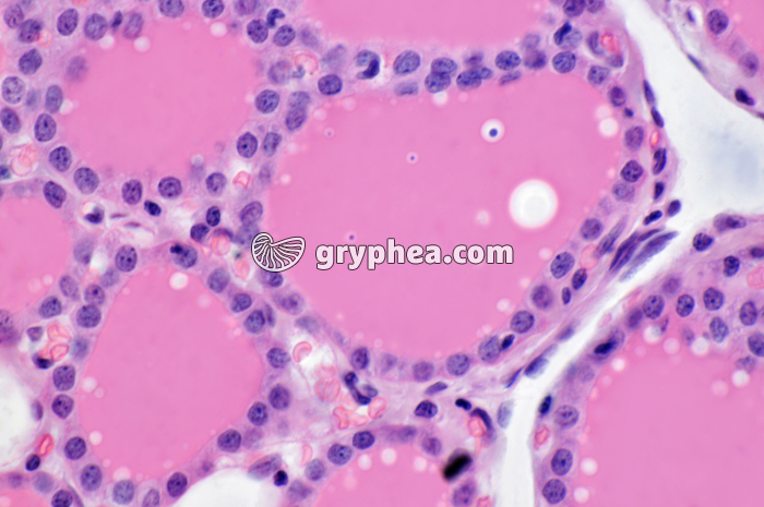 Thyroïde x200 - gryphea.com